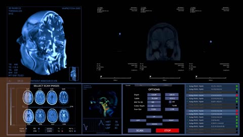 Dartmouth Scientists Have Created a New Template of the Human Brain