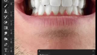 Yellow Teeth 😭 | Learn Photoshop