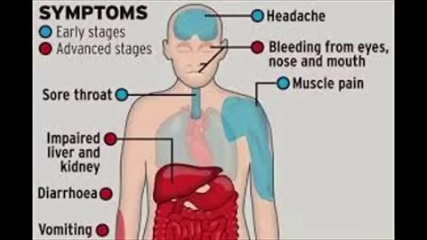 MARBURG VIRUS SYMPTOMS BLEEDING DISEASE - BY DECANTERBURY