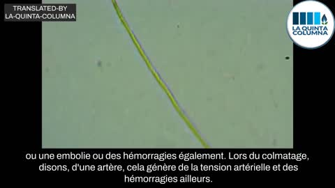 Présence de nanotubes de carbone à base de graphène dans le "vaccin" Pfizer