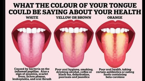 Diseases You Can Identify by Observing Tongue Color #healthmatters #foryou