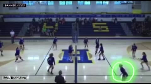 Trans man caused brain damage to female volleyball player.