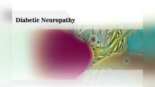 Diabetic Neuropathy