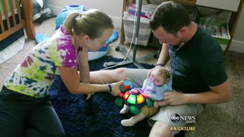 'Miracle Baby' Born Without Most of His Brain Defying Odds | ABC News