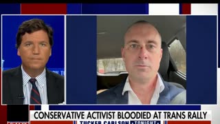 TUCKER CARLSON: The most shocking video of the year unreal. Trans woman uses full male force an innocent by standard cuts his face and criminal cop lies, Vancouver police chief backs the lying political cop on video. All documented on VIDEO WOW. Vancouver