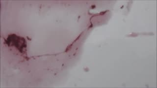 Morgellons - Organic Red Wine Spit Test - NANO-BOTS