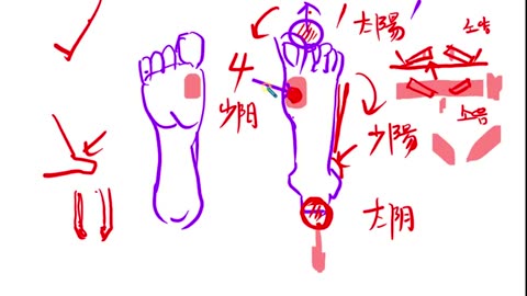 족저근막염과구두3, 반룡인수한의원, 강남구청역, 한태영원장님, 사상의학