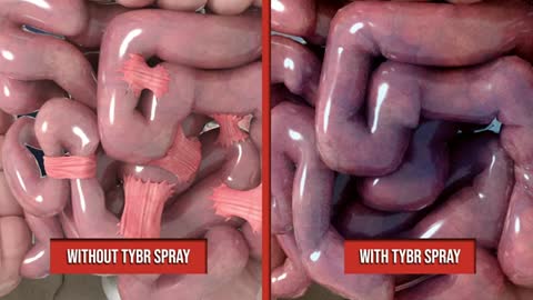 TYBR Health - TYBR Spray adhesion prevention technology