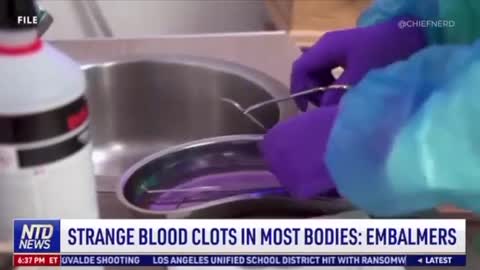 Strange Blood Clots found in bodies