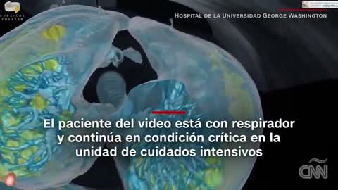 watch 3d video how corona virús attacks the lungs