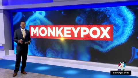 Jacksonville-area doctor frustrated over lack of monkeypox prevention