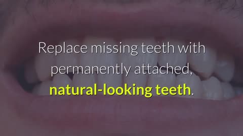 Teeth whitening Yakima | 509728932 | tewdental.com