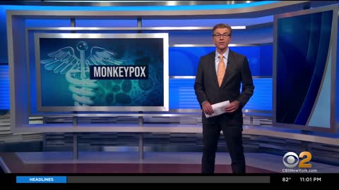 NYS health department declares monkeypox outbreak an imminent threat