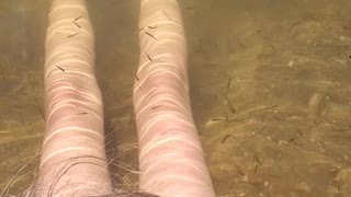 Skin therapy!! Hundreds of fishies nibbling on your legs
