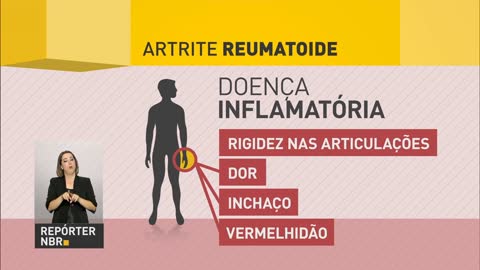 Treatment for rheumatoid arthritis will be available free of charge by SUS