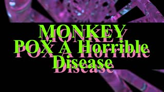 Severe Monkeypox in Hospitalized Patients — United States, August 10–October 10, 2022
