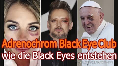 Black Eye Club