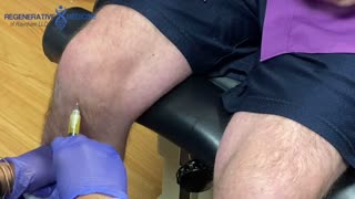 From Chronic Knee Pain to Pain Free Real Stories of A2M Injection Success