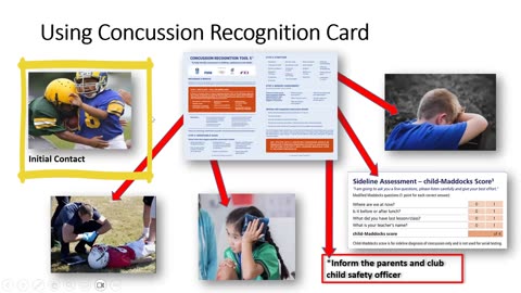 Pediatric Concussion in Sport
