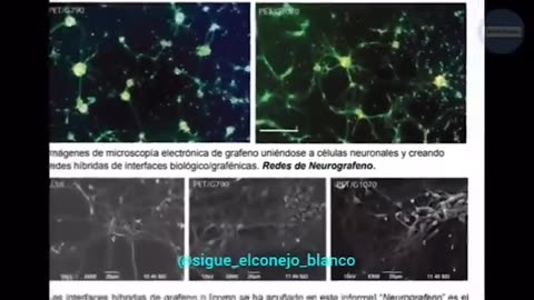 Consecuencias de las vacunas con grafeno