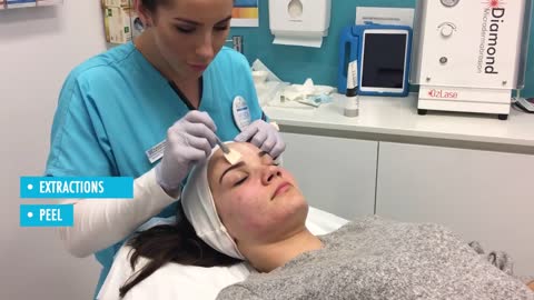 Exclusive High Performance Microdermabrasion