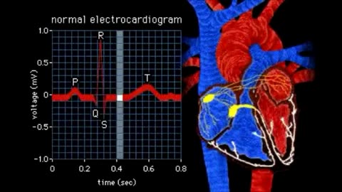 Electrocardiogram (ECG) Waves