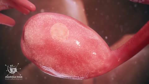 Ovulation amd Mensturation (3D Animation)