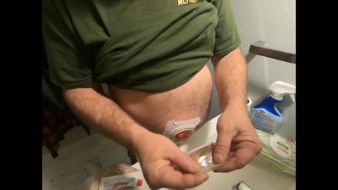 Ostomy bag pouch change. Warning graphic.