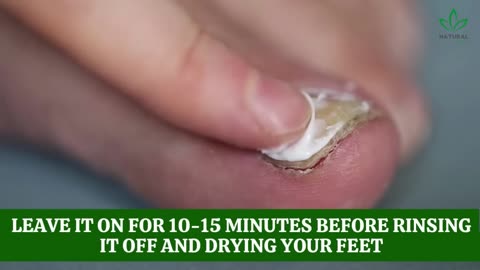 Only 2 ingredients are required to completely remove nail fungus.