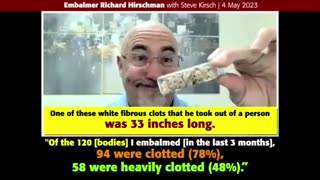 78% of dead bodies have white fibrous clots (caused by vaccine), notes embalmer, Richard Hirschman