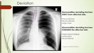 Basic chest xray