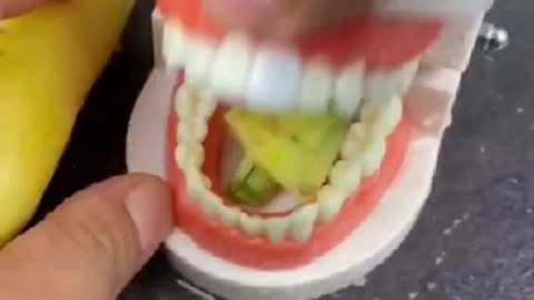 Funny Dental restoration