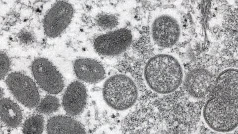 Health officials continue to struggle to contain monkeypox virus