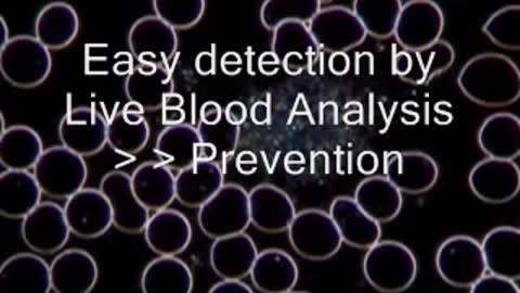 Dark Field Microscopy Live Blood Analysis - Cardio-Vascular Disease