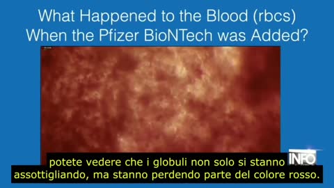 Blood reaction to Pfizer BioNTech "vaccine"
