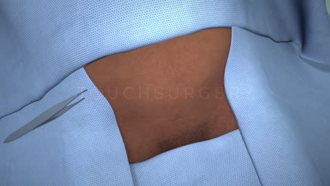 Touch surgery simulation process video
