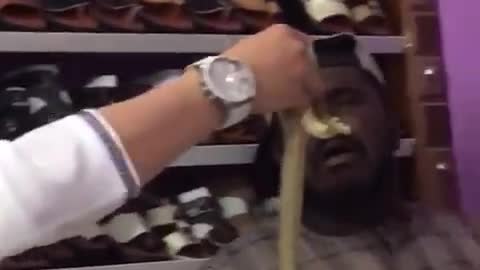 Arabi Scarred from snake in Dubai