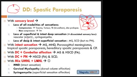 Neurology Examination MRCP PACES (Lecture 5) (Spastic Paraparesis 1)