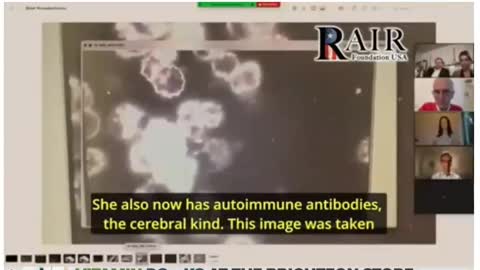 German doctors discovering foreign objects in vaccines and the blood of the vaccinated