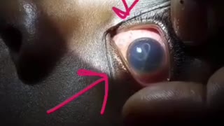 How a Parasite Looks Through a Kid's Eye - SCARY