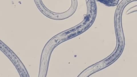 how to scanning bacteria inside nel