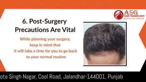Learn About FUT and FUE Hair Transplant Procedures
