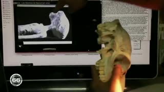 NASCA ALIENS IN MEXICO THEIR ANATOMY DISCOVERED AND SHOWN TO THE WORLD