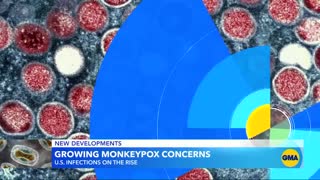 US leads world monkeypox cases l GMA