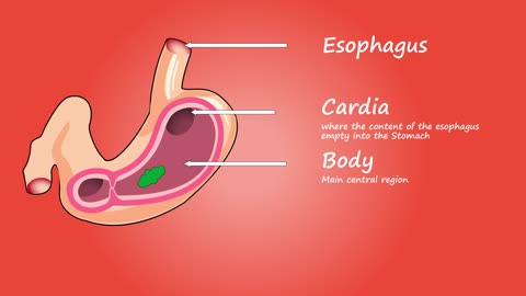 Stent insertion