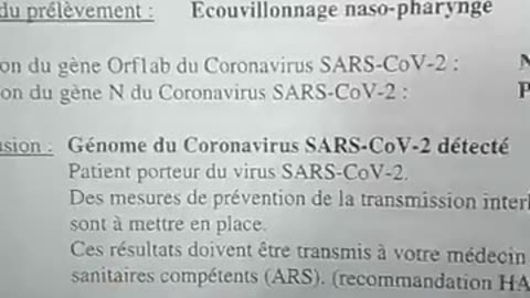 une infirmiere denonce la derive du test PCR au cycles aberrants