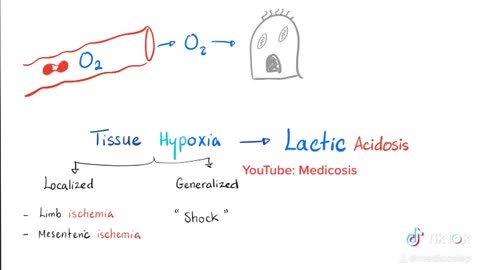 Lactic Acidosis and Tissue Ischemia
