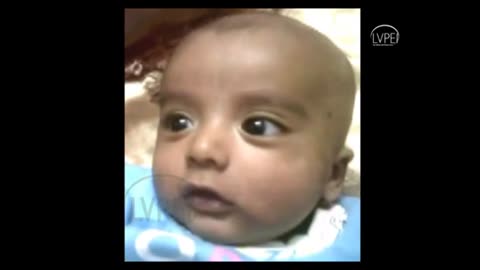 Paroxysmal Tonic Downgaze in Infancy- A Baby with Abnormal Downward Eye Movements