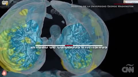 How Covid-19 Attacks the Lungs, 3D Video Reveals / cómo ataca el Covid-19 a los pulmones