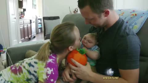 'Miracle Baby' Born Without Most of His Brain Defying Odds | ABC News